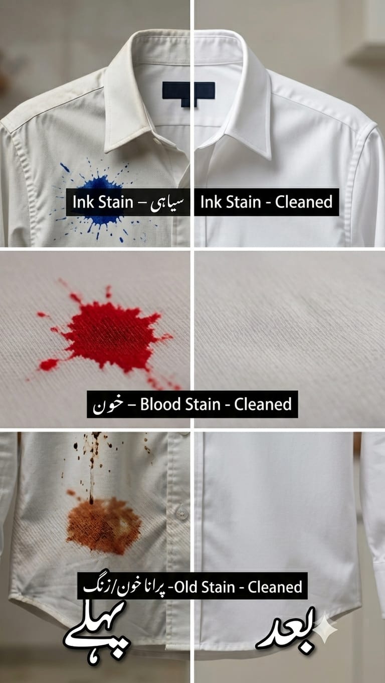 REMOVER KIT
